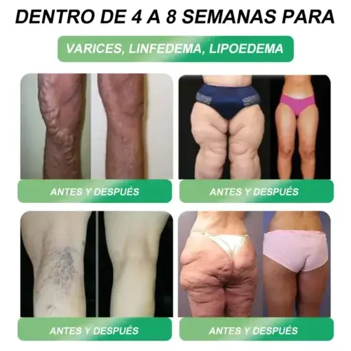 ๐๐๐-๐ ๐บ๐ฐ๐ฟ-๐ฐ๐ต-๐ถ๐ต๐ฌ ๐ฏ๐๐๐๐๐ ๐บ๐๐๐๐๐๐๐ ๐ถ๐๐๐ ๐ณ๐๐๐๐๐