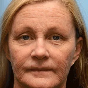 𝐅𝐢𝐫𝐦𝐢𝐧𝐠 𝐂𝐫𝐞𝐚𝐦