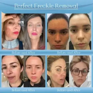 Anti-Wrinkle Skin Cream