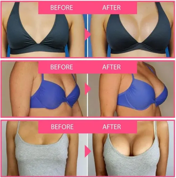 Bee Toxin Lift Cream