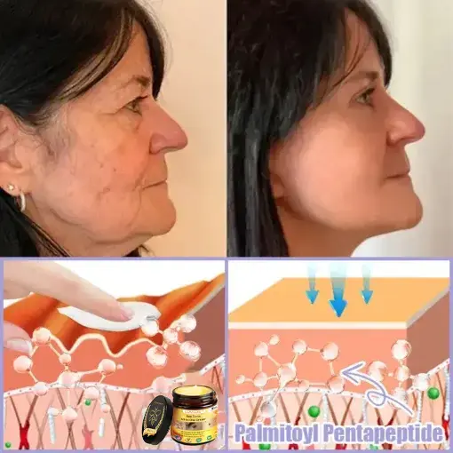 Bee Toxin Lift Cream