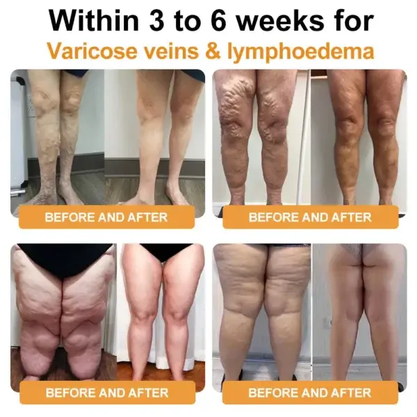 Bee Venom Lymphatic Drainage & Slimming Foot SoakBeads