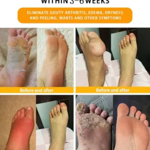 Bee Venom Lymphatic Drainage & Slimming Foot SoakBeads