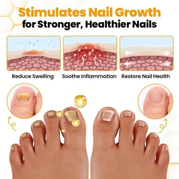 BeeVenom Anti-Fungal Nail Renewal Oil