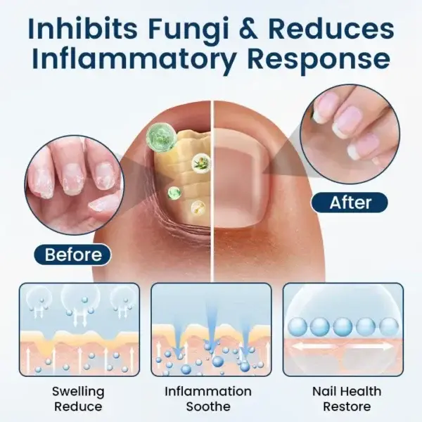 Fungal Repair Herbal Spray