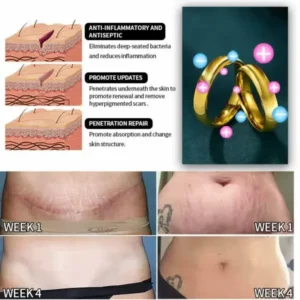 Lymphatic magnetic therapy cats eye ring