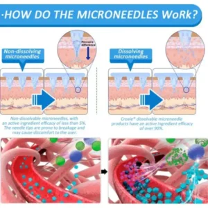 Nano Microneedle Patch with SMGT-GLP-1 & Matrixyl 3000