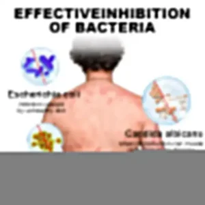 Psoriasis Cure Cream