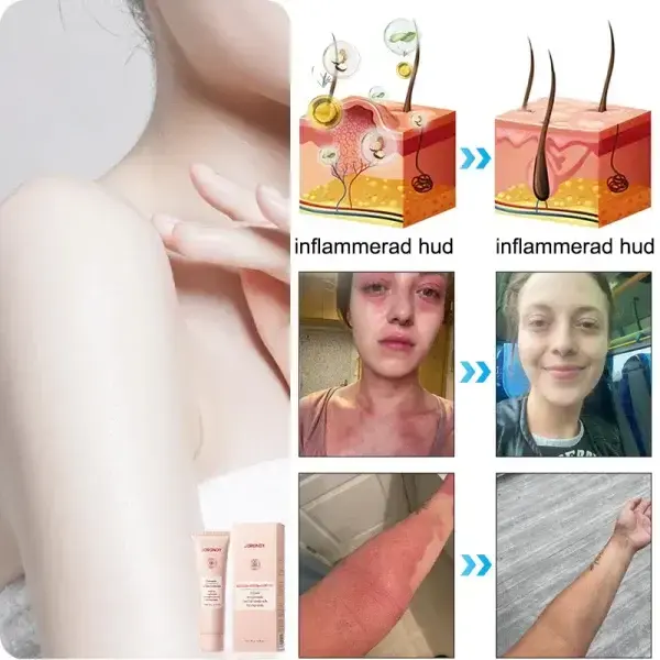 Purifying Peeling Gel