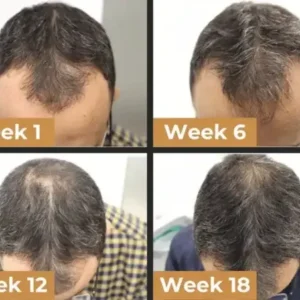 Root Activator Shampoo