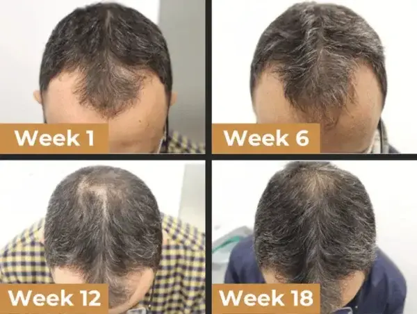 Root Activator Shampoo