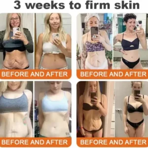 Royal Jelly Moisturizing Lifting Cream