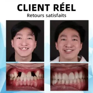 Silicone Reline Denture Set