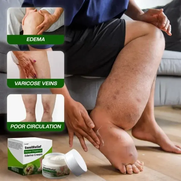 SwellRelief Horse Chestnut Edema Cream