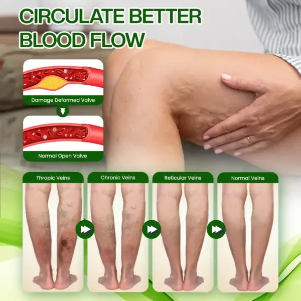 SwellRelief Horse Chestnut Edema Cream