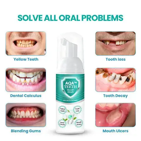 Teeth Mouthwash – Solve all Oral Problems