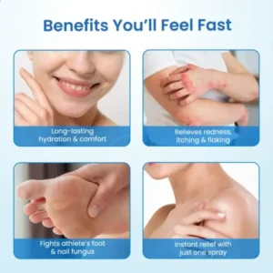 Timilk® MagnesiumHerb Psoriasis Relief Cream