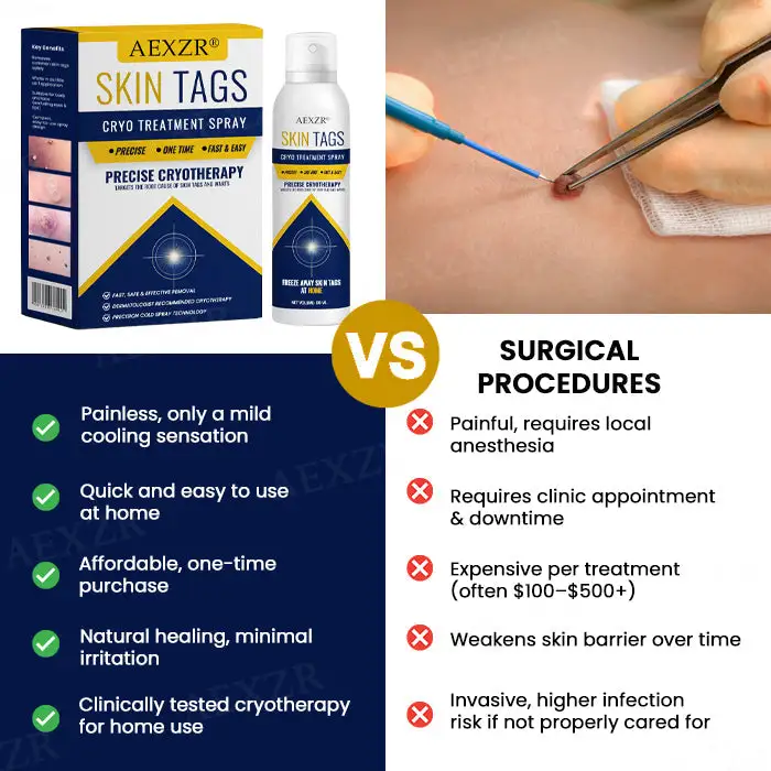 Skin Tag Cryo Treatment Spray - Image 6