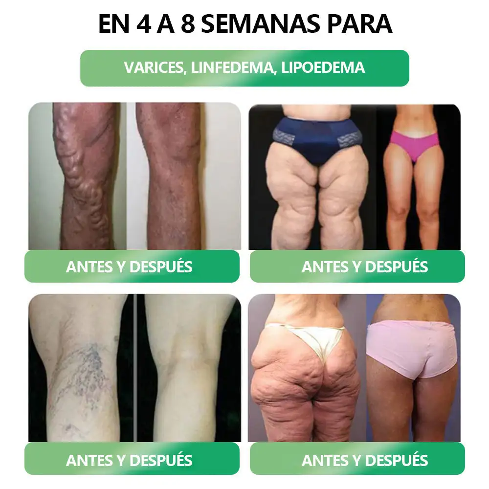 ð®ð¬-ðð-ð ððšð¥ð®ðð¢ðšÌð§ ð©ðð«ð ð¥ð ð¬ðð¥ð®ð ðð¢Ìðªð®ð¢ððš ðšð«ðð¥ - Image 6