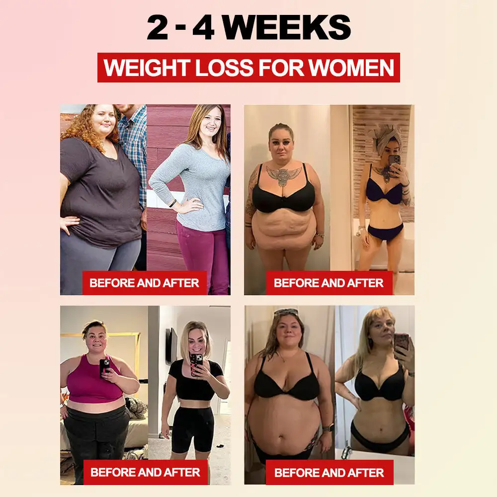 ๐
๐ข๐๐๐ซ ๐๐ง๐ ๐๐จ๐ซ๐ฆ๐ฐ๐จ๐จ๐ ๐๐จ๐๐ฒ ๐๐ก๐๐ฉ๐ข๐ง๐ ๐๐๐ข๐ฌ๐ญ ๐๐ซ๐จ๐ญ๐๐๐ญ๐จ๐ซ - Image 2