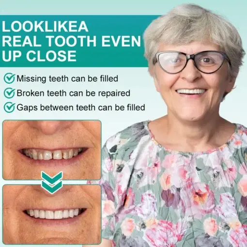 ๐๐ป๐๐๐ฎ๐ป๐ ๐ฆ๐๐ถ๐ฐ๐ธ-๐ผ๐ป ๐๐ฒ๐ป๐๐ฎ๐น ๐ฉ๐ฒ๐ป๐ฒ๐ฒ๐ฟ๐ - Image 2