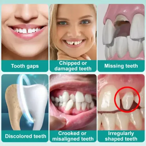 ๐๐ป๐๐๐ฎ๐ป๐ ๐ฆ๐๐ถ๐ฐ๐ธ-๐ผ๐ป ๐๐ฒ๐ป๐๐ฎ๐น ๐ฉ๐ฒ๐ป๐ฒ๐ฒ๐ฟ๐ - Image 3