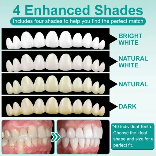 ๐๐ป๐๐๐ฎ๐ป๐ ๐ฆ๐๐ถ๐ฐ๐ธ-๐ผ๐ป ๐๐ฒ๐ป๐๐ฎ๐น ๐ฉ๐ฒ๐ป๐ฒ๐ฒ๐ฟ๐ - Image 5