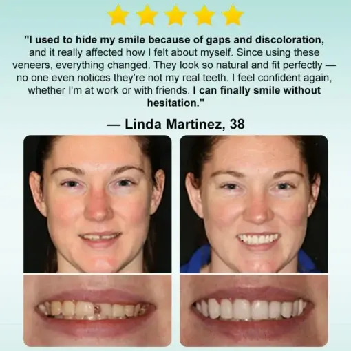 ๐๐ป๐๐๐ฎ๐ป๐ ๐ฆ๐๐ถ๐ฐ๐ธ-๐ผ๐ป ๐๐ฒ๐ป๐๐ฎ๐น ๐ฉ๐ฒ๐ป๐ฒ๐ฒ๐ฟ๐ - Image 8