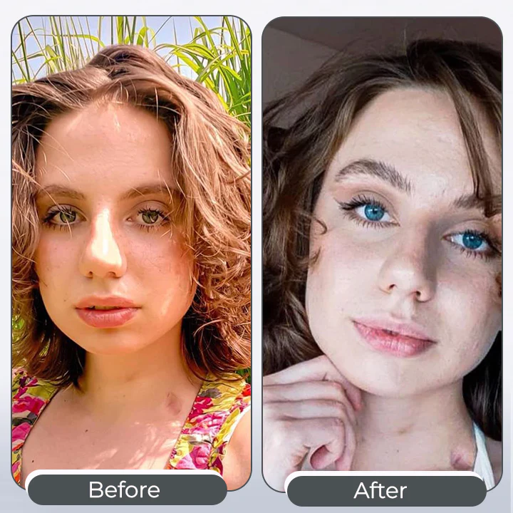 Enhancement & Changing Eye Color Eye Drops - Image 2