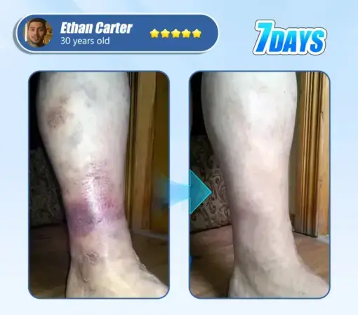 Diabetic Skin Revolution - Image 2