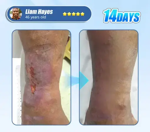 Diabetic Skin Revolution - Image 3