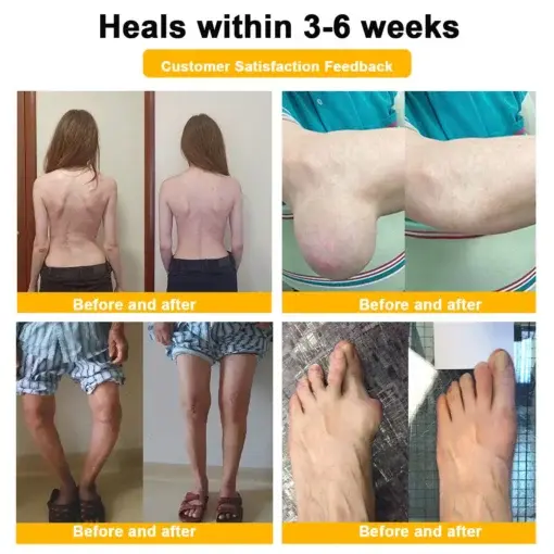 Bee-Venom Pain-Relief Bone Healing Cream - Image 2