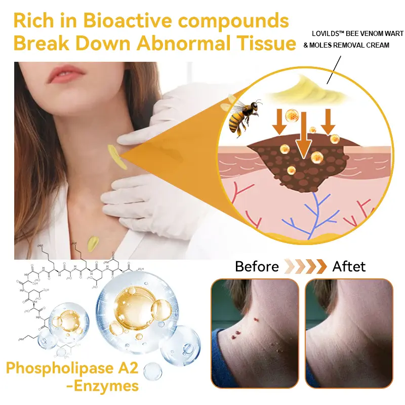 Bee Venom Wart & Moles Removal Cream - Image 10