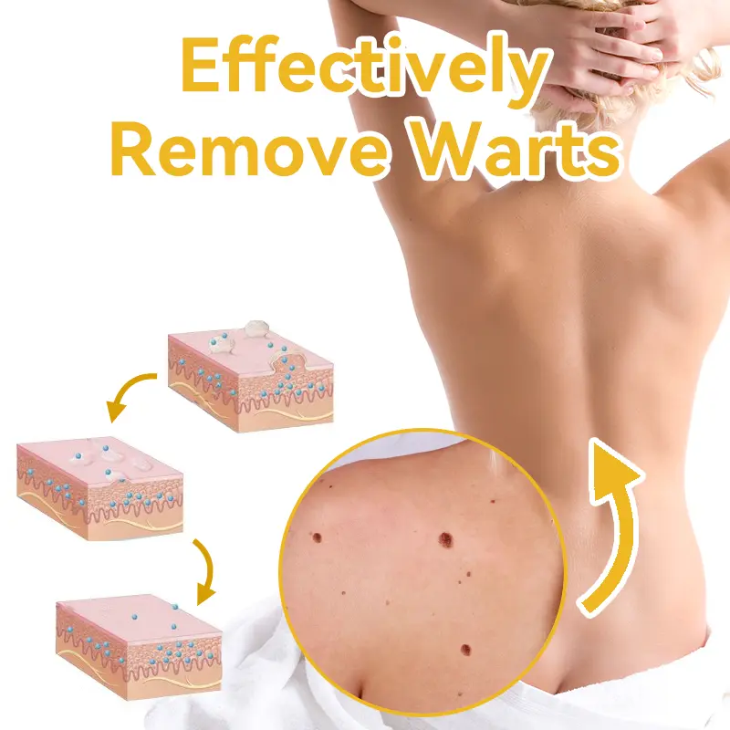 Bee Venom Wart & Moles Removal Cream - Image 14