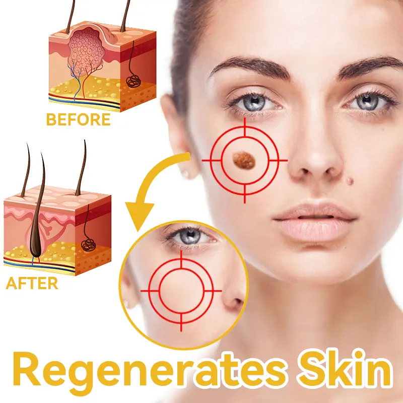 Bee Venom Wart & Moles Removal Cream - Image 16