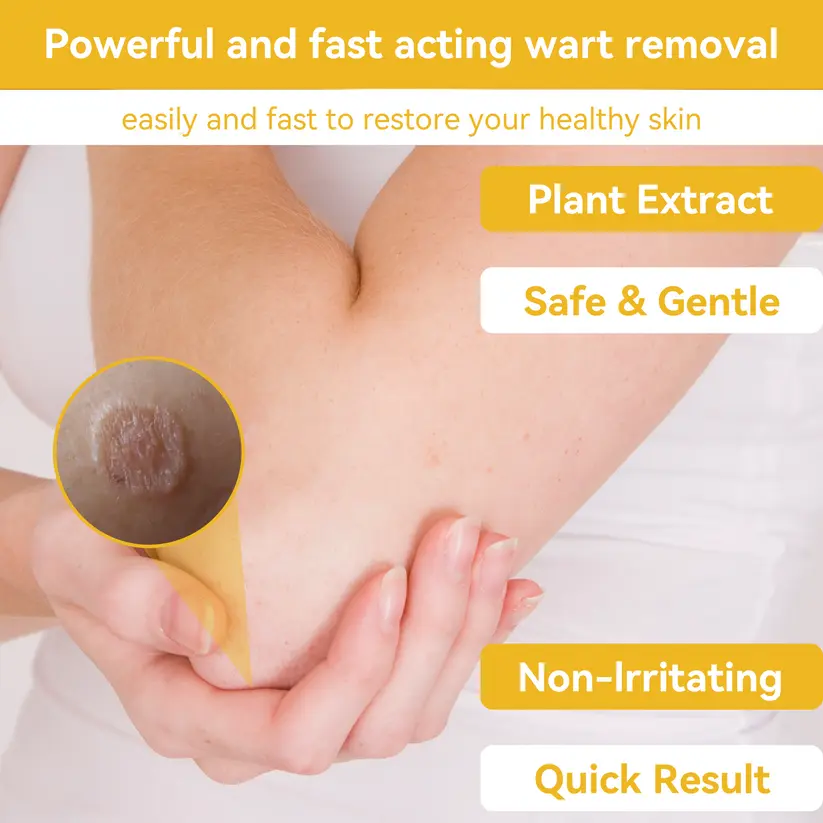 Bee Venom Wart & Moles Removal Cream - Image 17