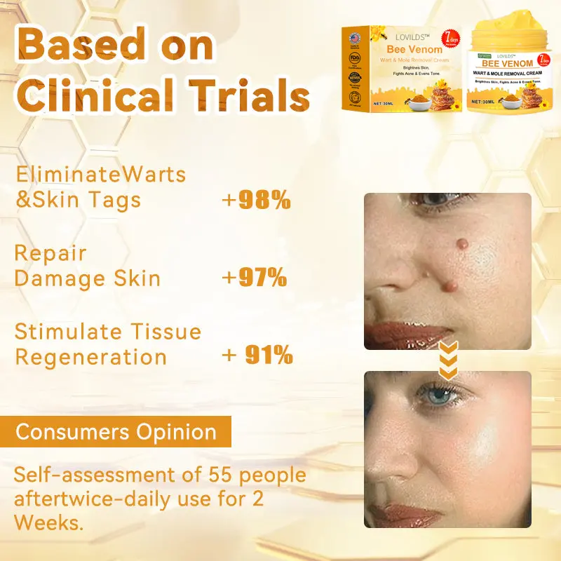 Bee Venom Wart & Moles Removal Cream - Image 8