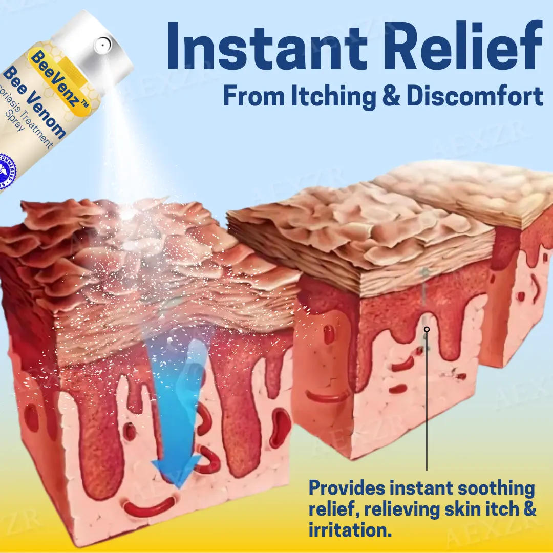 Bee Venom Psoriasis Treatment Spray - Image 4