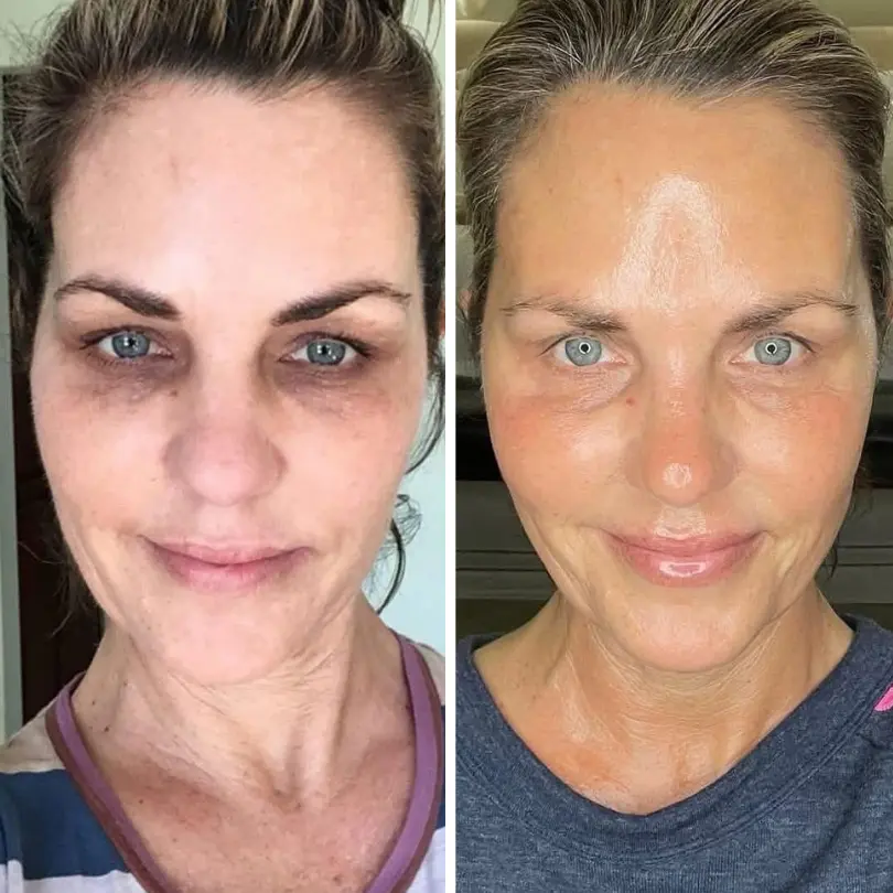 LiftRenew All-in-One Under-Eye Stick - Image 4