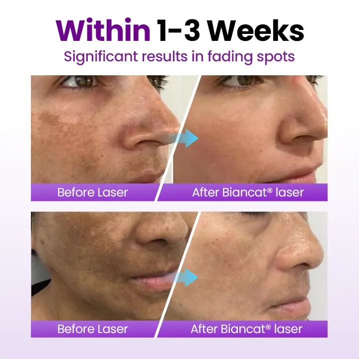 SpotErase Probiotic Shield Serum - Image 4