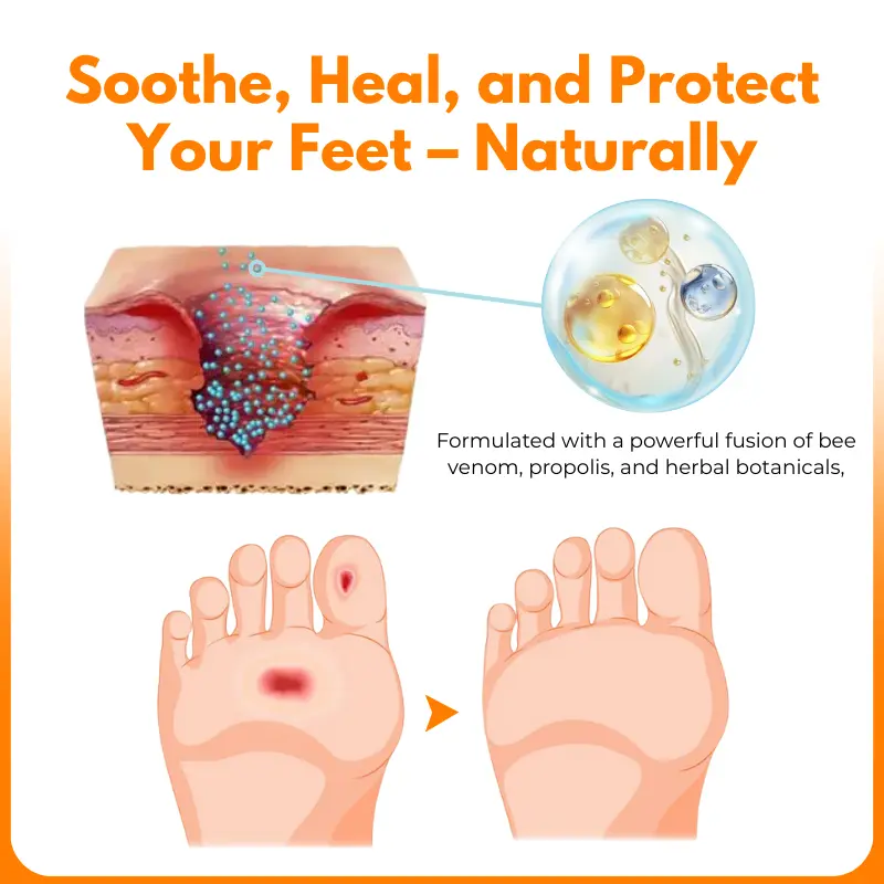 VenHeal Bee Venom Diabetic Wound Spray - Image 5