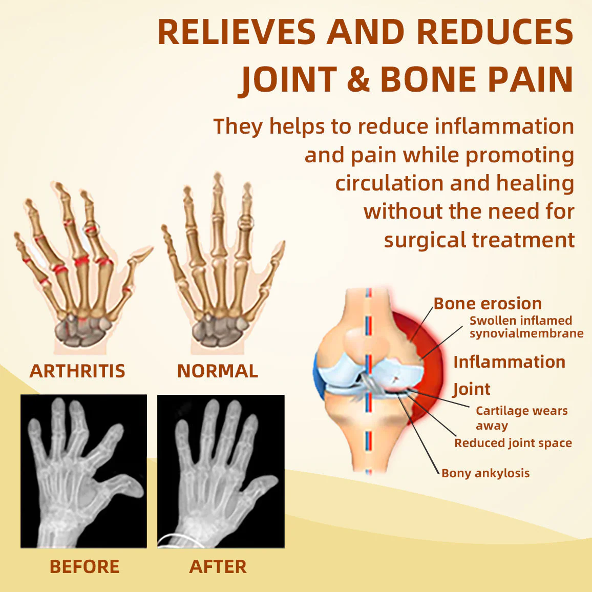 Canadian honey bee Venom Pain and Bone Healing Cream - Image 2