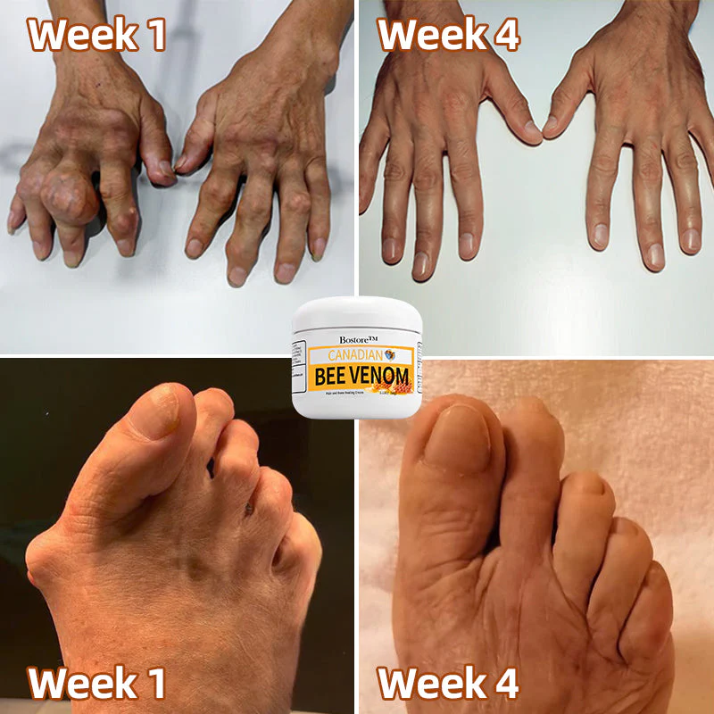 Canadian honey bee Venom Pain and Bone Healing Cream - Image 3