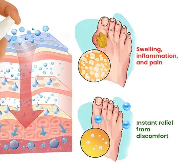 GoutEase Relief Spray - Image 8