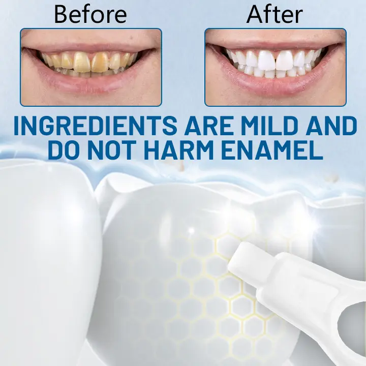 Highly effective tooth stain cleaner - Image 3