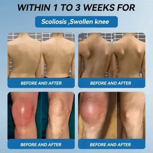 ʙ.ᴘ.ᴄ-157 Joint Healing Cream - Image 3