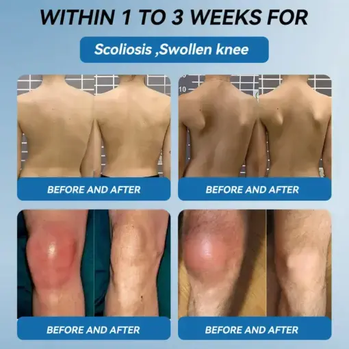 ʙ.ᴘ.ᴄ-157 Joint Healing Cream - Image 3