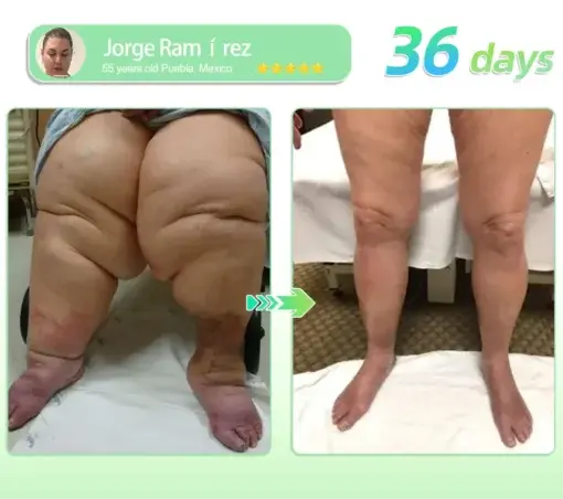 𝑺𝑰𝑿-𝑰𝑵-𝑶𝑵𝑬 𝑯𝒆𝒂𝒍𝒕𝒉 𝑺𝒐𝒍𝒖𝒕𝒊𝒐𝒏 𝑶𝒓𝒂𝒍 𝑳𝒊𝒒𝒖𝒊𝒅 - Image 7