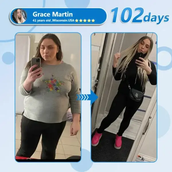 Nano Microneedle Patch with SMGT & Matrixyl 3000 - Image 6