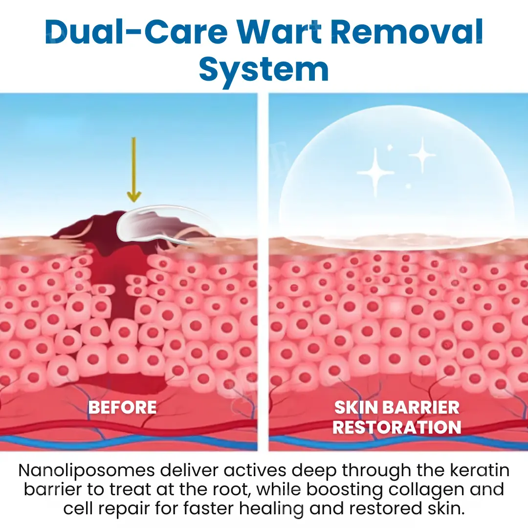 Nanolipo Genital Warts Relief Cream - Image 6